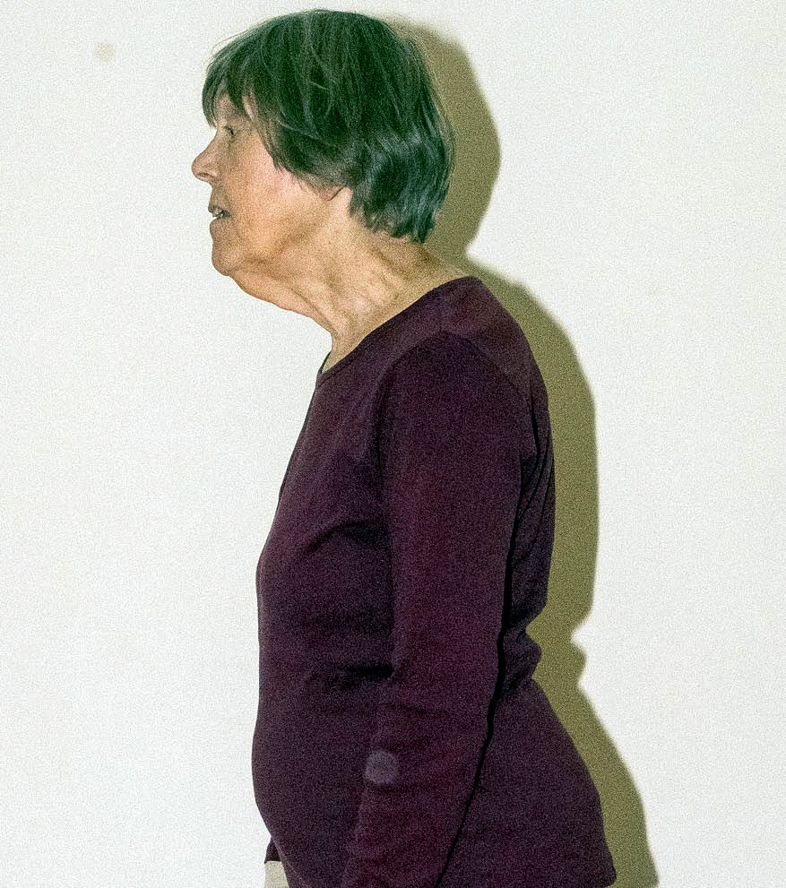 Profile view showing the head carried forward of the shoulders